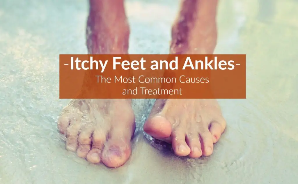 arches of feet itch
