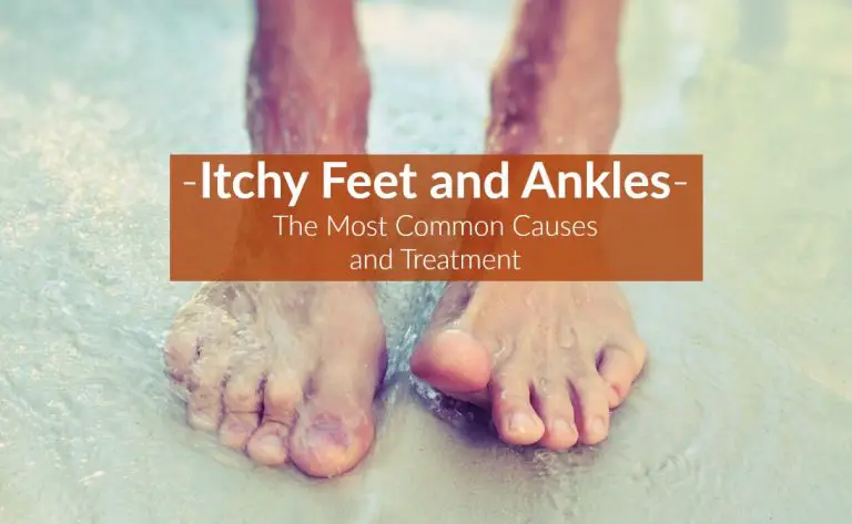 why-are-my-feet-itchy-at-night-per-toda-la-informaci-n-del-pa-s