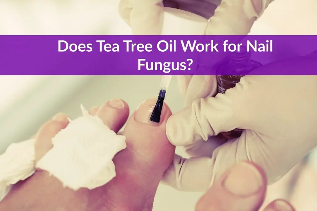 Does Tea Tree Oil Work For Nail Fungus The Healthy Apron 2283