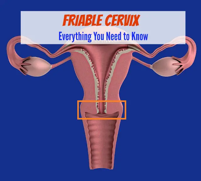 Friable Cervix Everything You Need To Know The Healthy Apron