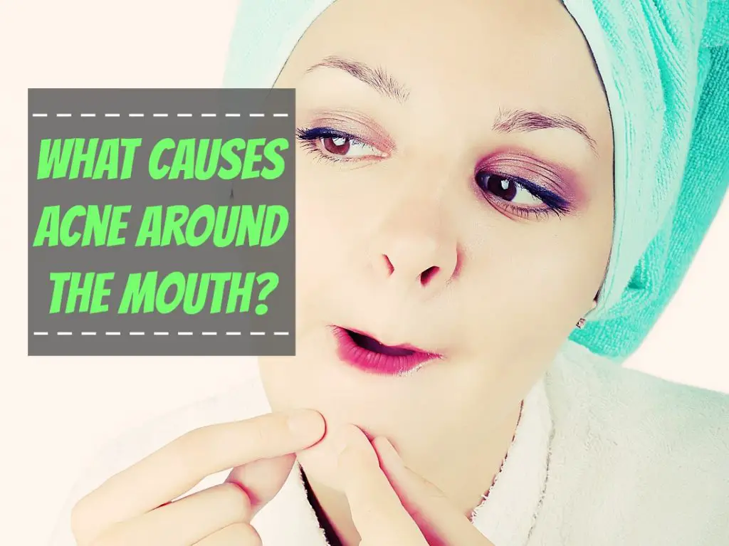 what-causes-acne-around-the-mouth-the-healthy-apron